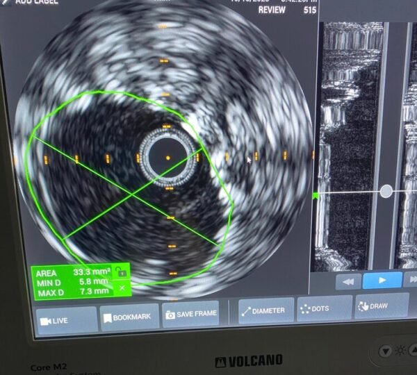 Symmetry Vascular Center